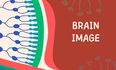 BRAIN IMAGE